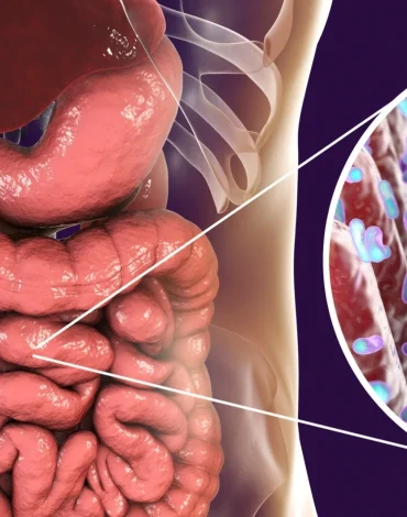 Alerji (bağırsak bağışıklık ilişkisi üzerinden değerlendirilir)