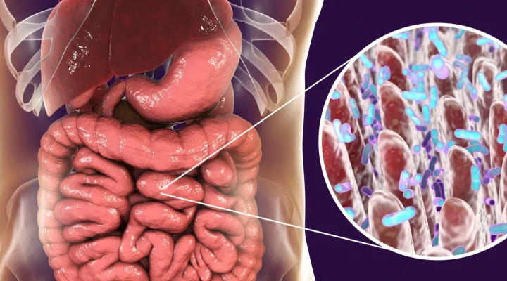 Alerji (bağırsak bağışıklık ilişkisi üzerinden değerlendirilir)