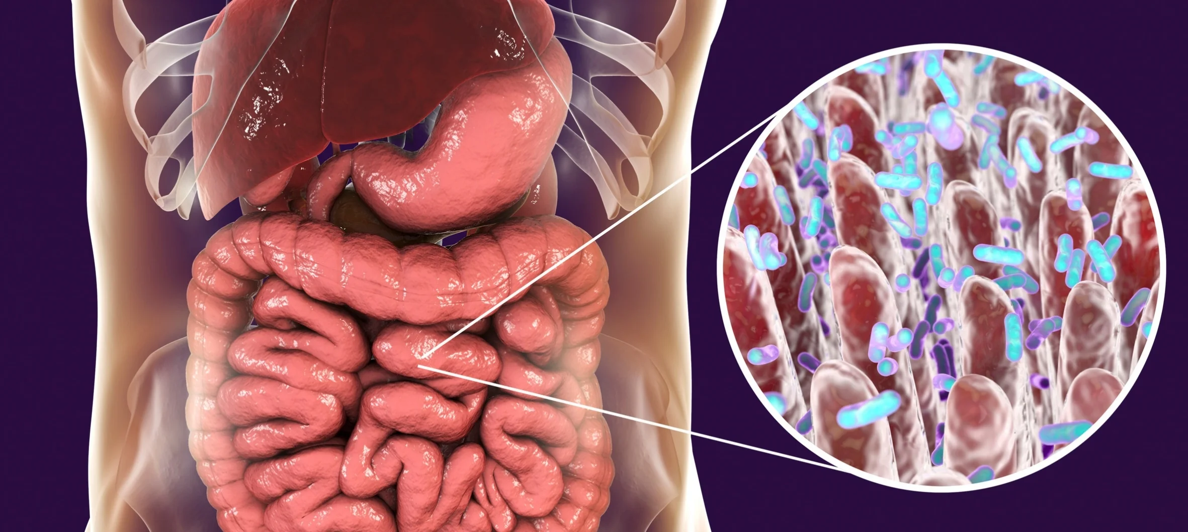 Alerji (bağırsak bağışıklık ilişkisi üzerinden değerlendirilir)