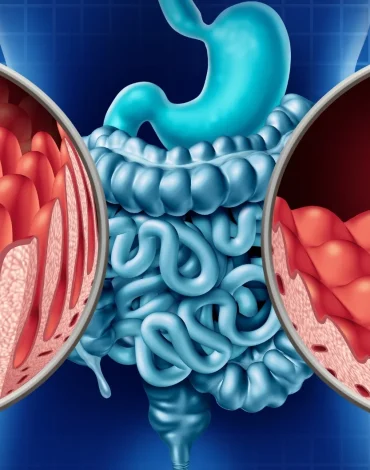 Bağırsak hastalıkları