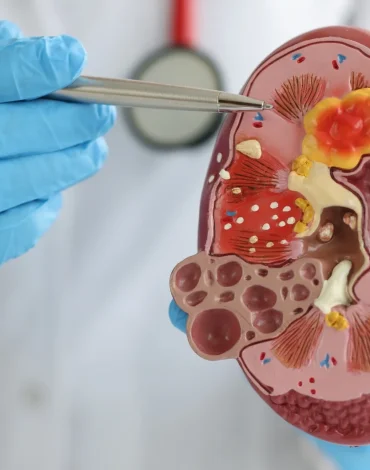 Kronik Hastalıklarda Beslenme Tedavisi