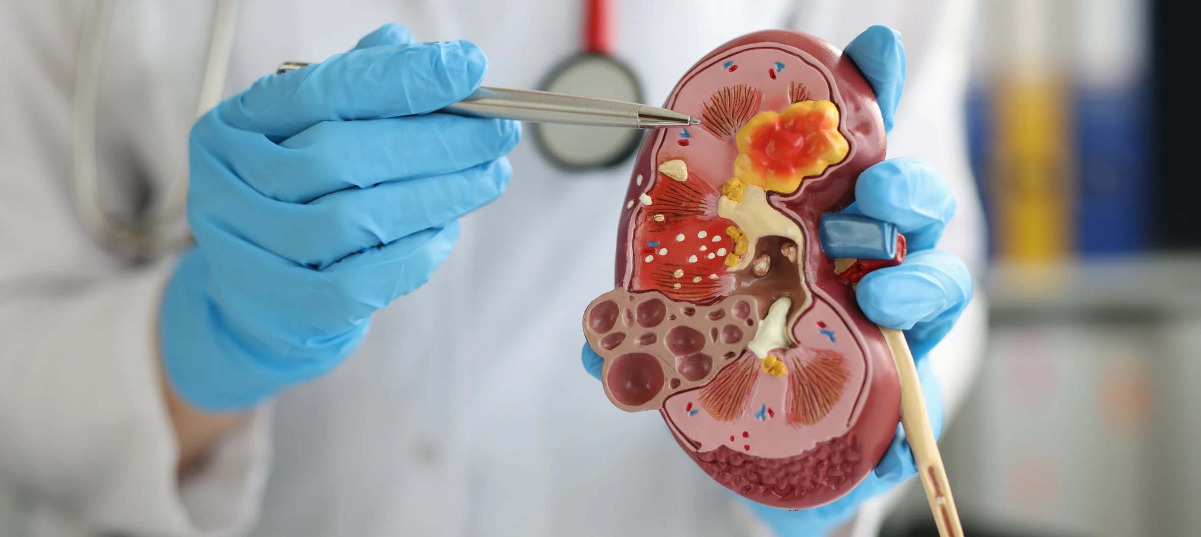 Kronik Hastalıklarda Beslenme Tedavisi