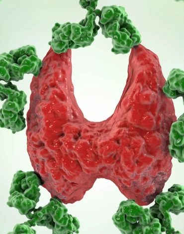 Otoimmün hastalıklar