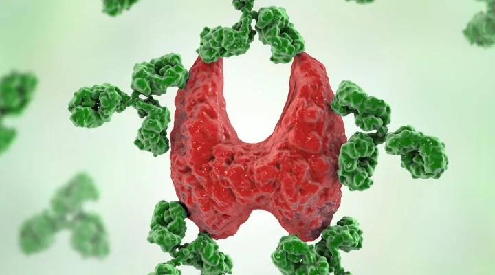 Otoimmün hastalıklar
