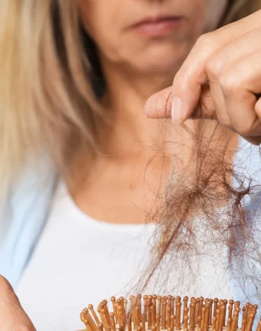 Diyet Sonrası Saç Dökülmesi Neden Olur