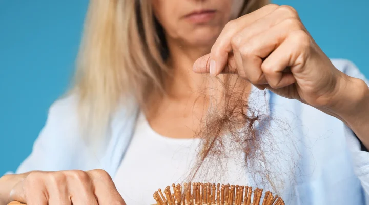 Diyet Sonrası Saç Dökülmesi Neden Olur