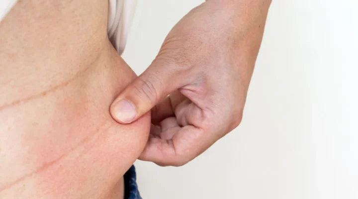 Diyet Sonrası Sarkma Neden Olur ve Nasıl Önlenir